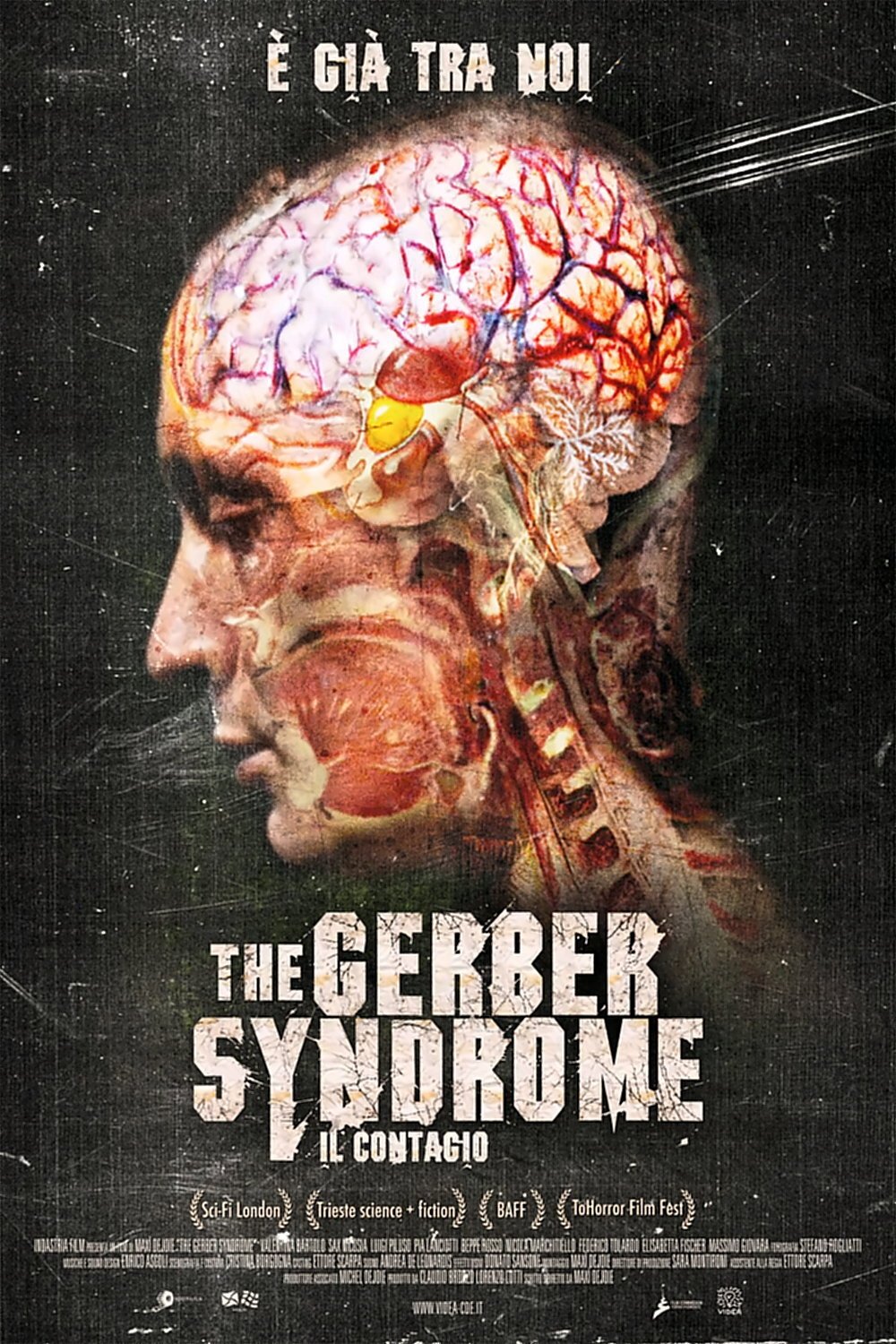 Locandina di The Gerber Syndrome - Il contagio